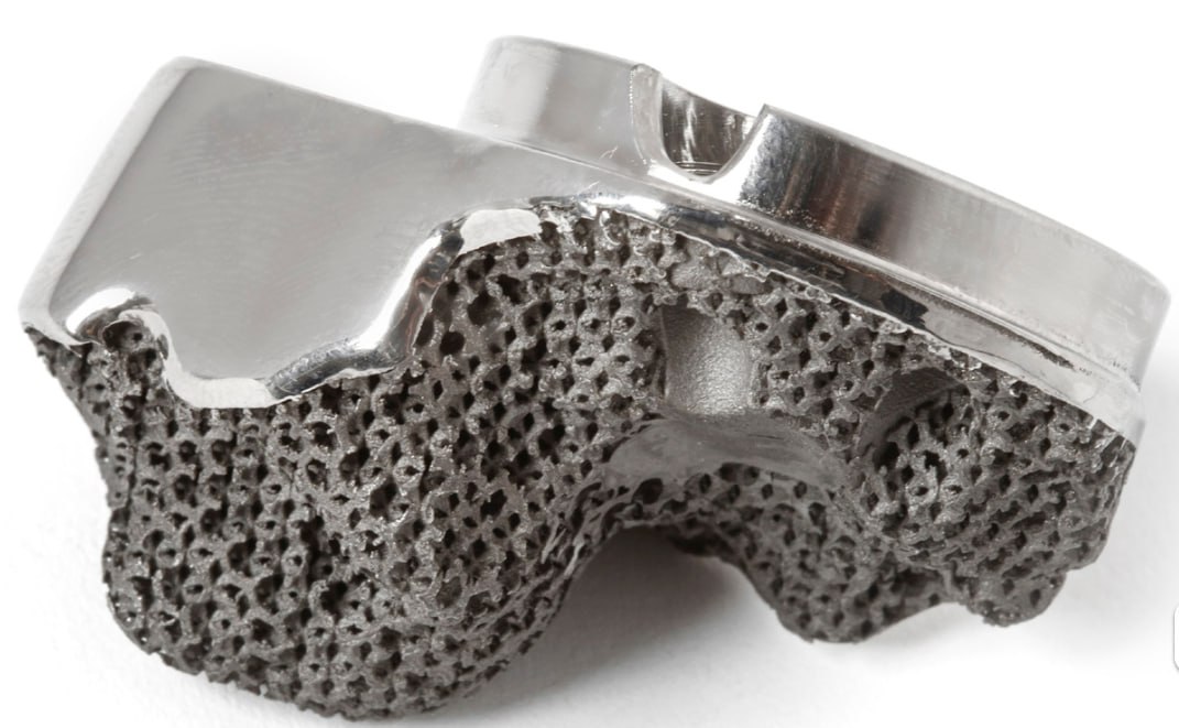 金属医疗植入物特写